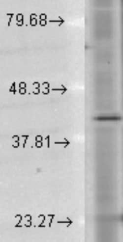 Rhodopsin Antibody (1D4), Novus Biologicals:Antibodies:Primary Antibodies